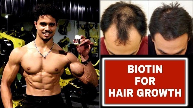 'Biotin Hair Growth Result Before And After || Fitness Master Deepak'